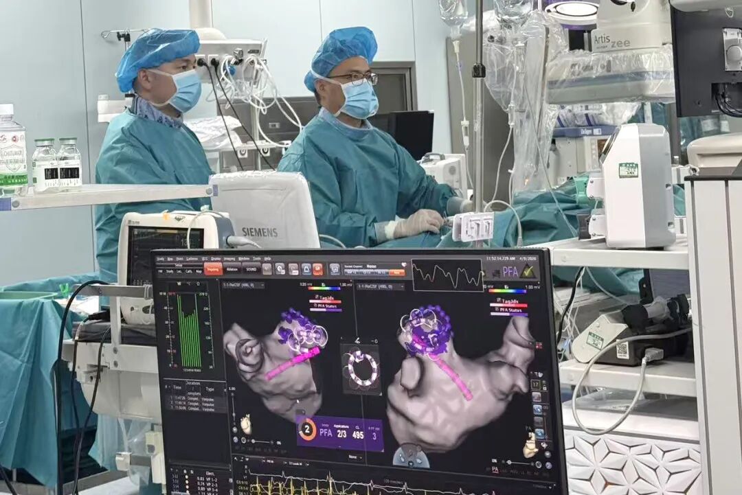 突破！我院为“手术禁区”患者成功施行清醒镇痛镇静下Varipulse脉冲电场消融术